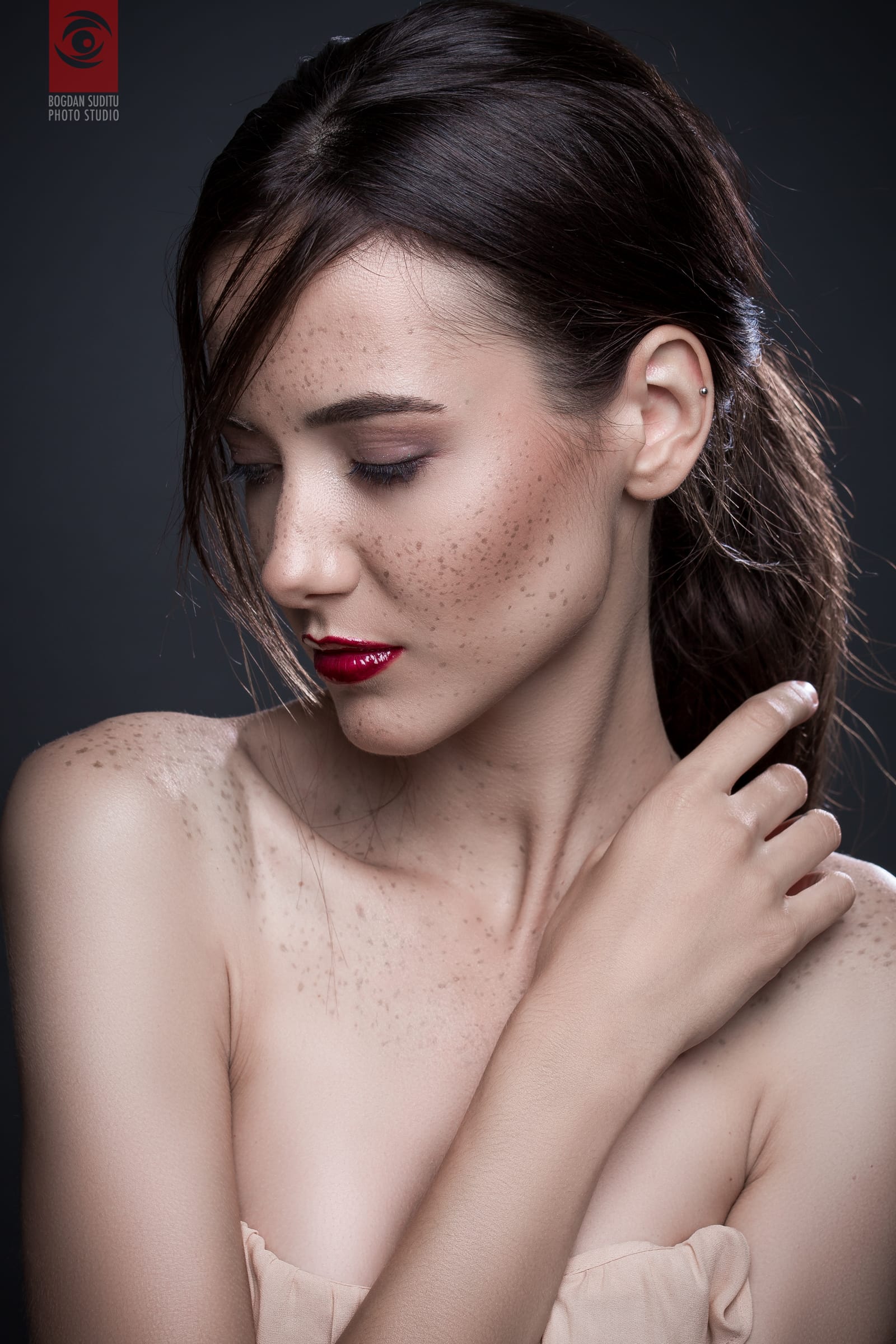 Freckles